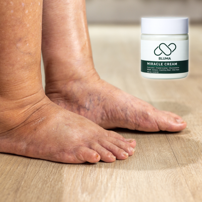 Bluma Miracle Cream™ Herbal Powerhouse