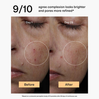 Bluma Clinical Brightening Toner with Azelaic Acid Derivative + 2% BHA