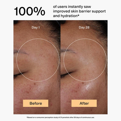 Bluma Clinical Brightening Toner with Azelaic Acid Derivative + 2% BHA